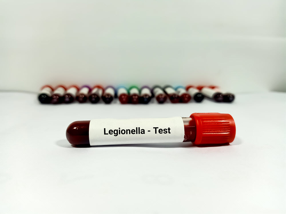 legionella