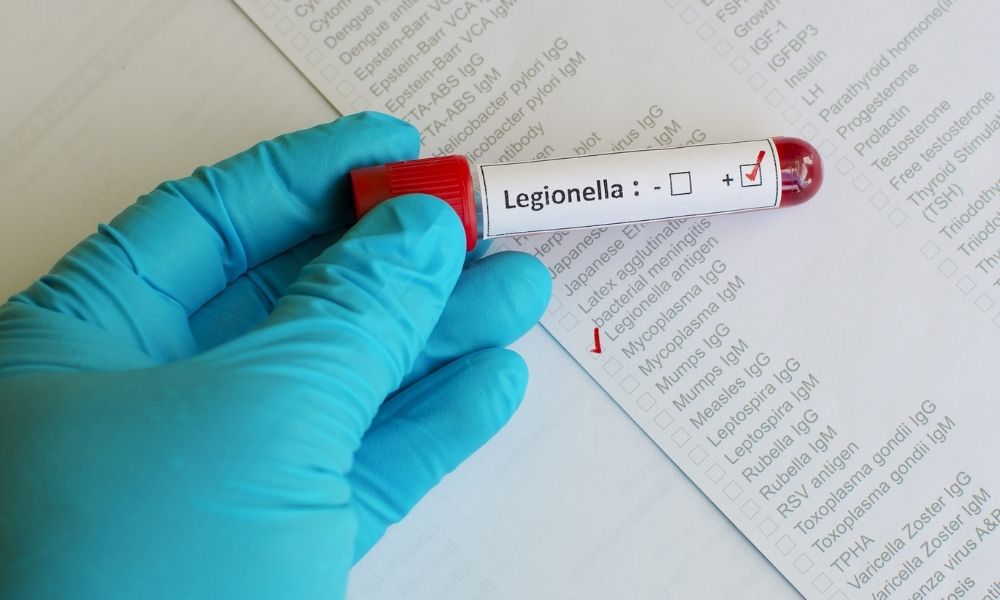 legionella